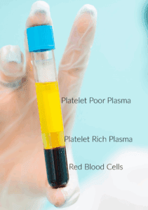 PRP
